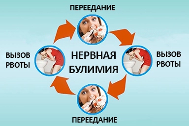 Лечение булимии в Кемерово